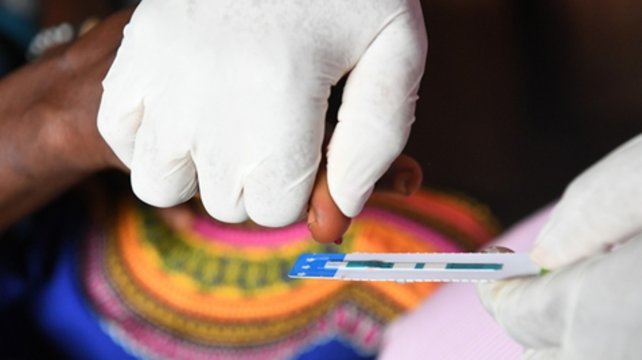 La primera vacuna para prevenir el VIH estaría disponible en cuatro años