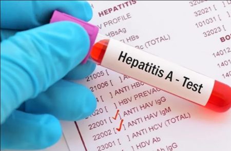 Aumentan los casos de hepatitis A en Argentina: los síntomas y quiénes deben vacunarse