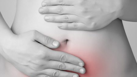 Taller sobre endometriosis y salud mental