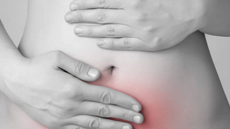 Taller sobre endometriosis y salud mental