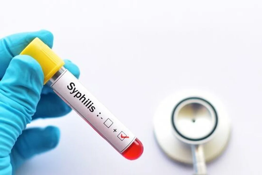 Casos de sífilis aumentaron 20,5% y preocupa el impacto en jóvenes en Argentina