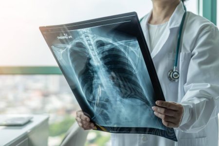 Día Mundial del Cáncer de Pulmón: alertan sobre aumento de casos en Argentina