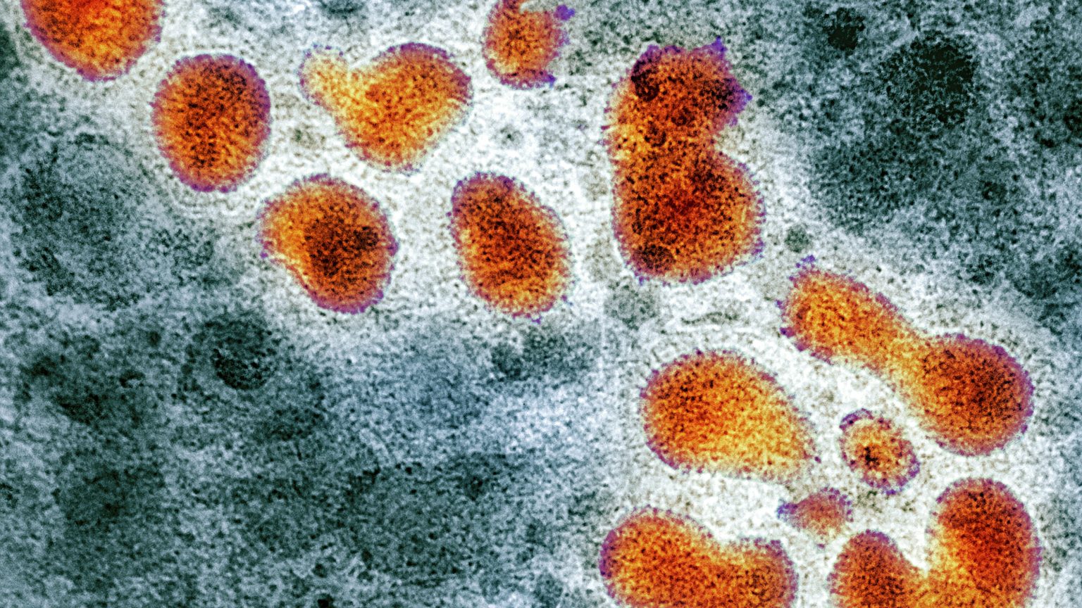 Europa refuerza medidas por una gripe que vuelve a saturar hospitales