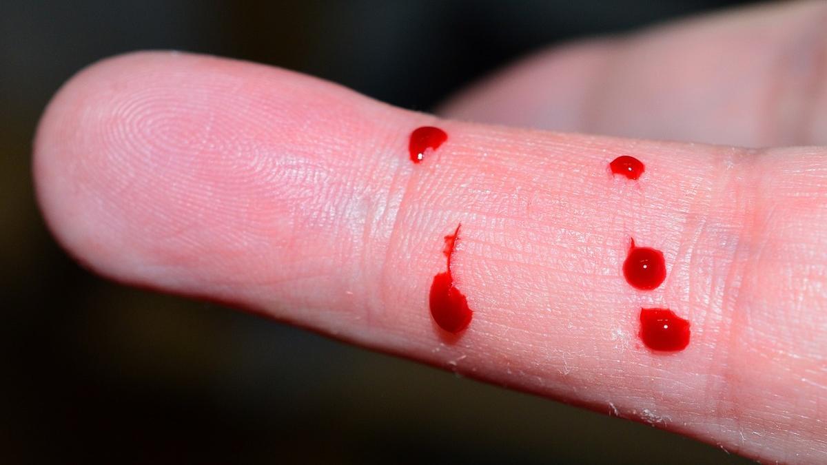 Hemofilia: ANMAT aprueba un tratamiento innovador para casos críticos