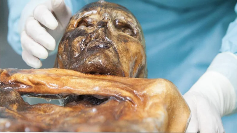 Investigadores examinan la momia de Ötzi con guantes estériles en el Museo Arqueológico del Tirol del Sur