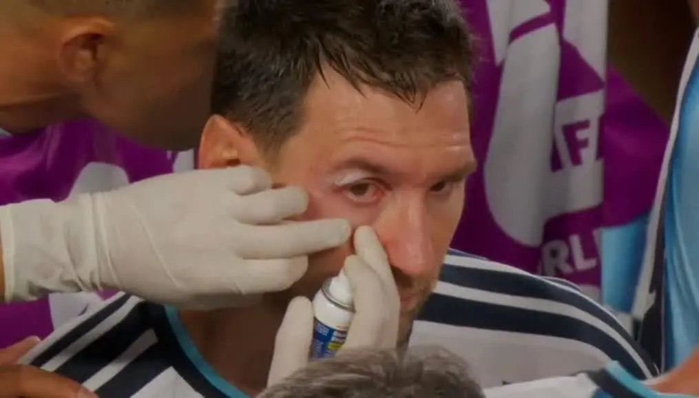 Alerta en la Selección: Lionel Messi sufrió un duro golpe en el rostro y terminó ensangrentado ante Suiza